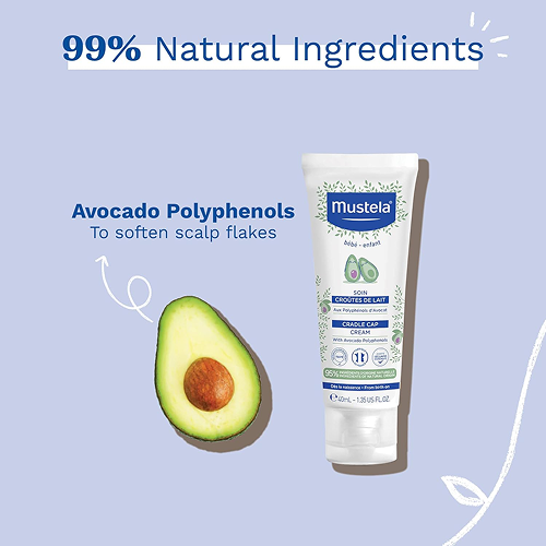 Cradle Cap Cream